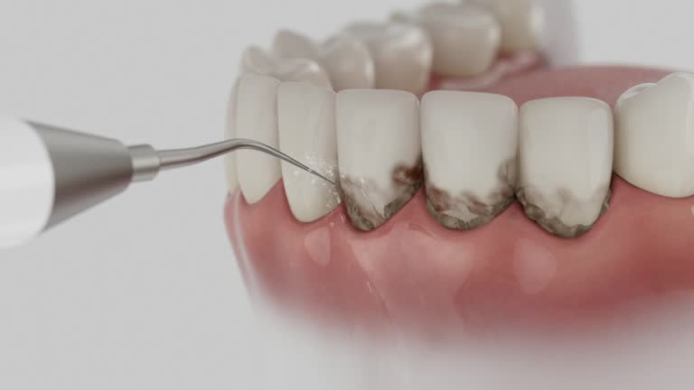 Trusted Wisdom Tooth Removal service in Chrisman, IL - Dentist Open Now